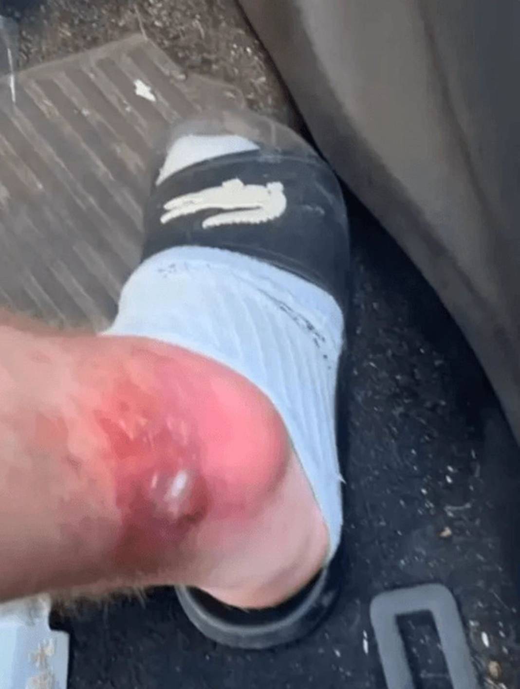 Bu otun sadece yanından geçti, hayatı karardı! Bir ömür onunla yaşayacak, kabus gibi 3